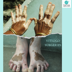 VITILIGO SURGERIES